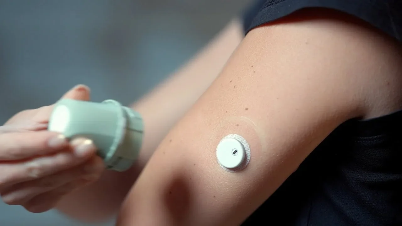 Sensor CGM di belakang lengan atas, aplikator masih di tangan